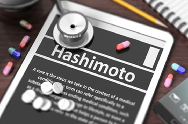 Na czym polega leczenie Hashimoto?